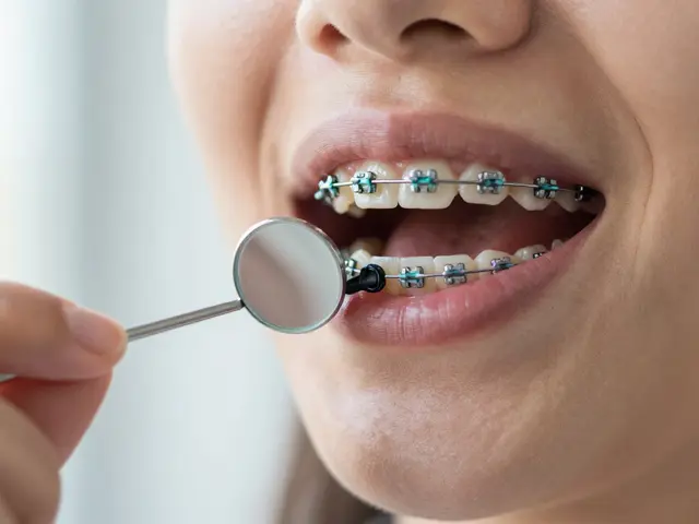 Gumičky na rovnátka: Jak zvládnout výměnu krok za krokem