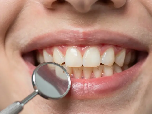 Zubní kámen pod dásní: jak ho odstranit a jaké jsou praktické rady