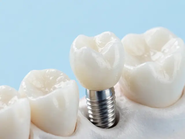 Jaké jsou možnosti náhrady zubu? Přehled moderních řešení