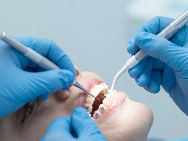 Které pojišťovny hradí dentální hygienu v roce 2026? Kompletní přehled pro Keramické rovnátka