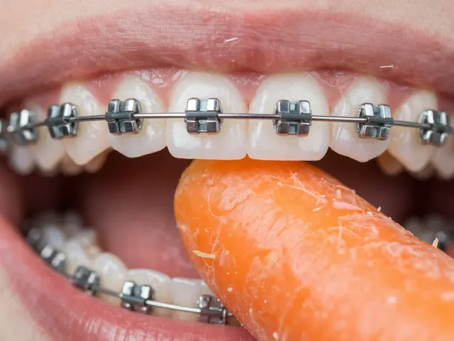 Co nejíst při fixních rovnátkách? Seznam zakázaných potravin pro bezpečné nošení