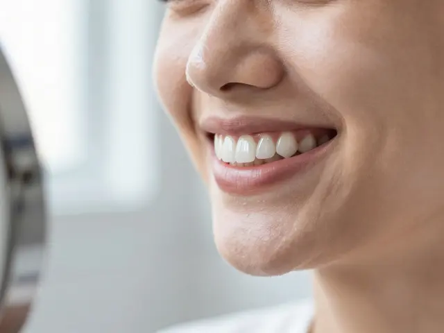 Veneers zuby: Kompletní přehled typů, cen a péče
